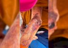 Idosa é achada ferida e desnutrida em Arealva; filha é presa por maus-tratos