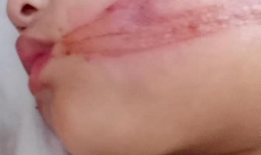 Fios soltos na rua deixam uma jovem e dois bebês feridos em Jaú