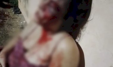 Grávida tem rosto deformado após ser espancada por marido em Tabatinga