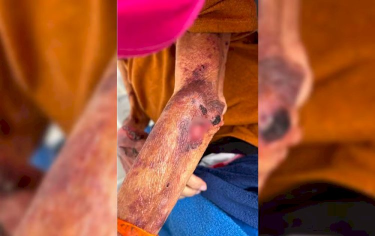 Idosa é achada ferida e desnutrida em Arealva; filha é presa por maus-tratos